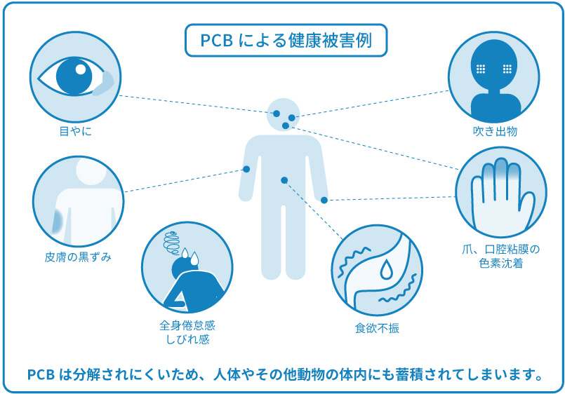 PCBによる健康被害例